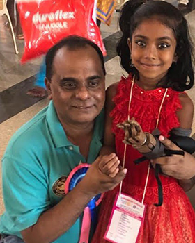 Kumar and prosthetic hand recipient